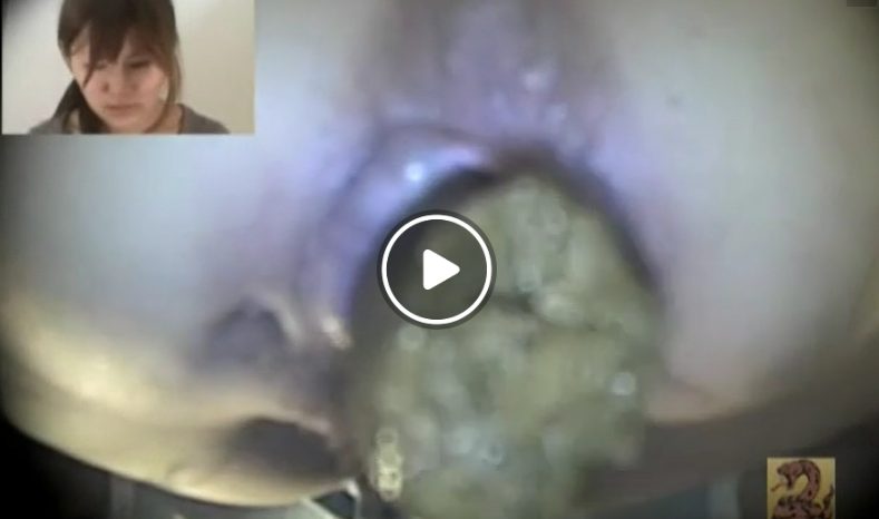 うんこが迫ってくる迫力