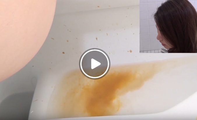 ゲリラ豪雨的な下痢便を排泄する女子